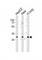 STOM Antibody (N-term)